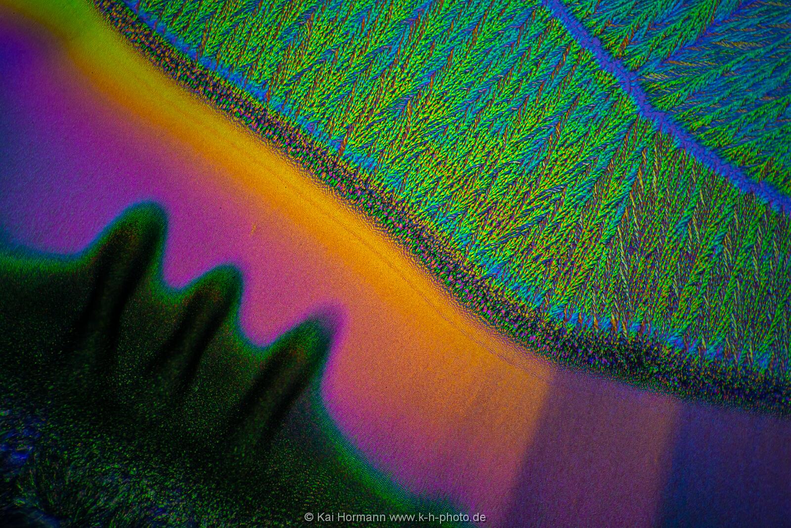 Ascorbinsäure (Vitamin C) Mikrokristalle im polarisierten Licht.