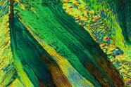 Bernsteinsäure Mikrokristalle im polarisierten Licht.