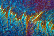 Pyridoxin (Vitamin B6) Mikrokristalle im polarisierten Licht.