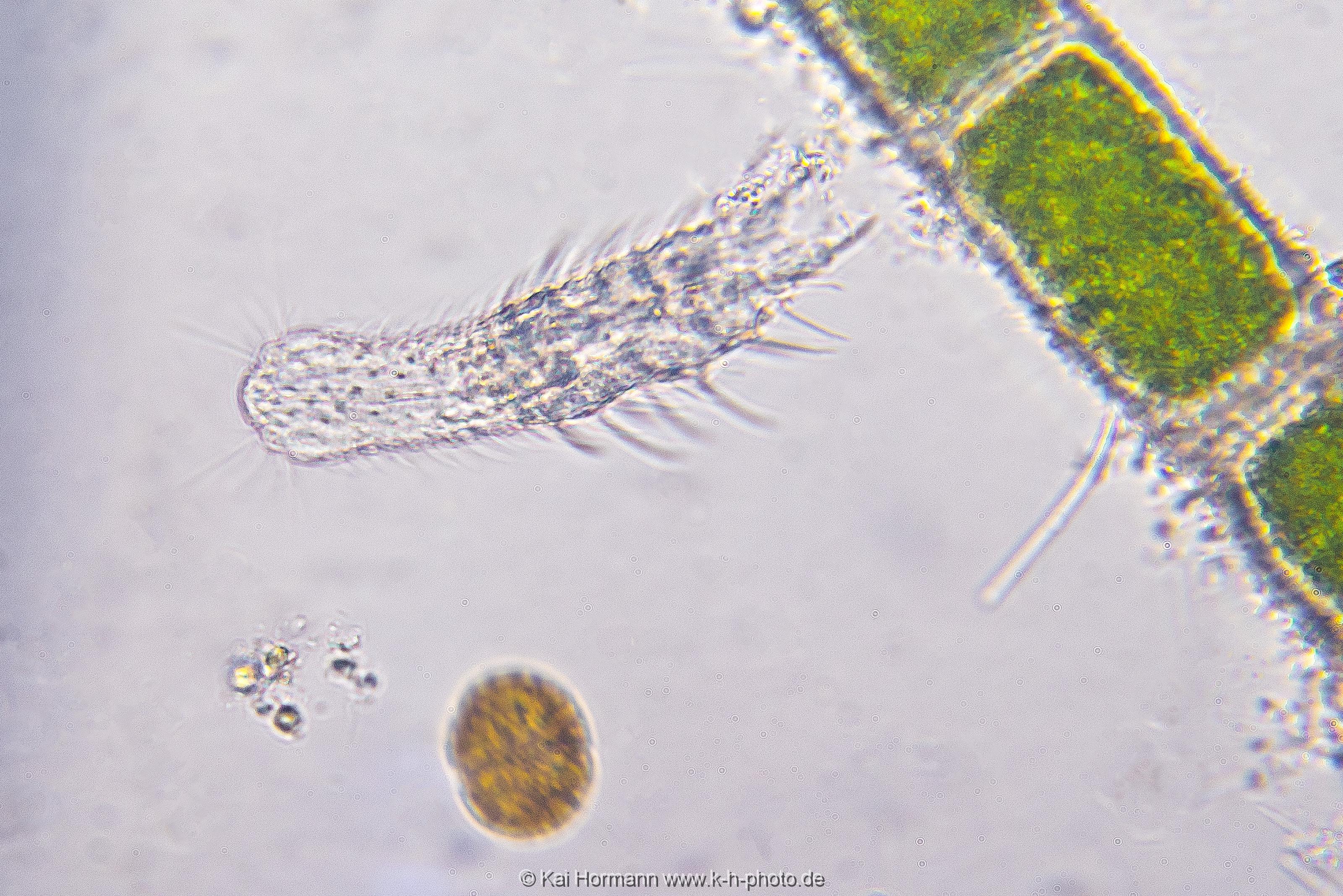 Bauchhärling Mikrofotografie: Mikroskopische Aufnahmen von Einzellern, Algen und Kleinstlebewesen.
