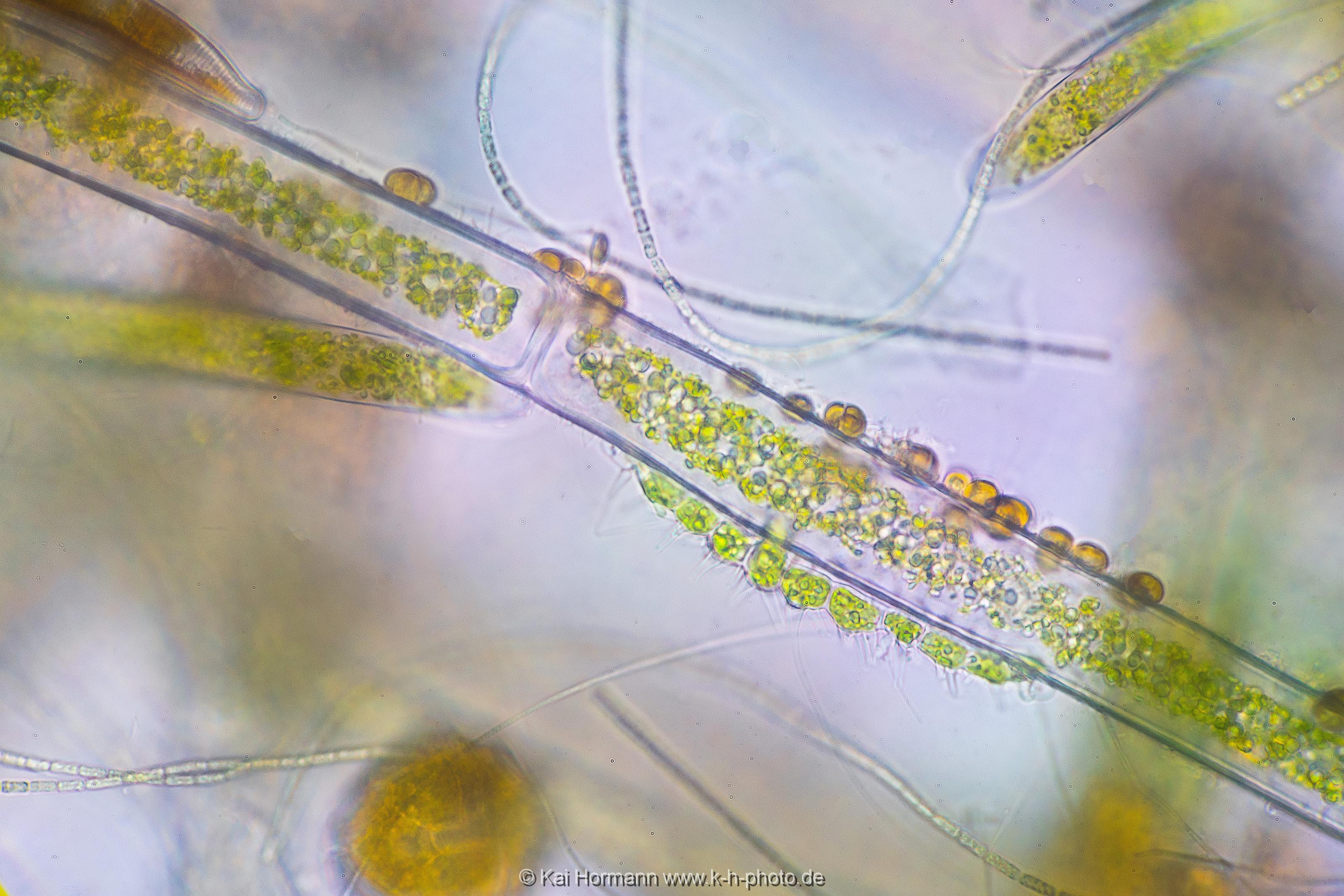 Goldalgen auf Faden-Grünalge. Mikrofotografie: Mikroskopische Aufnahmen von Einzellern, Algen und Kleinstlebewesen.