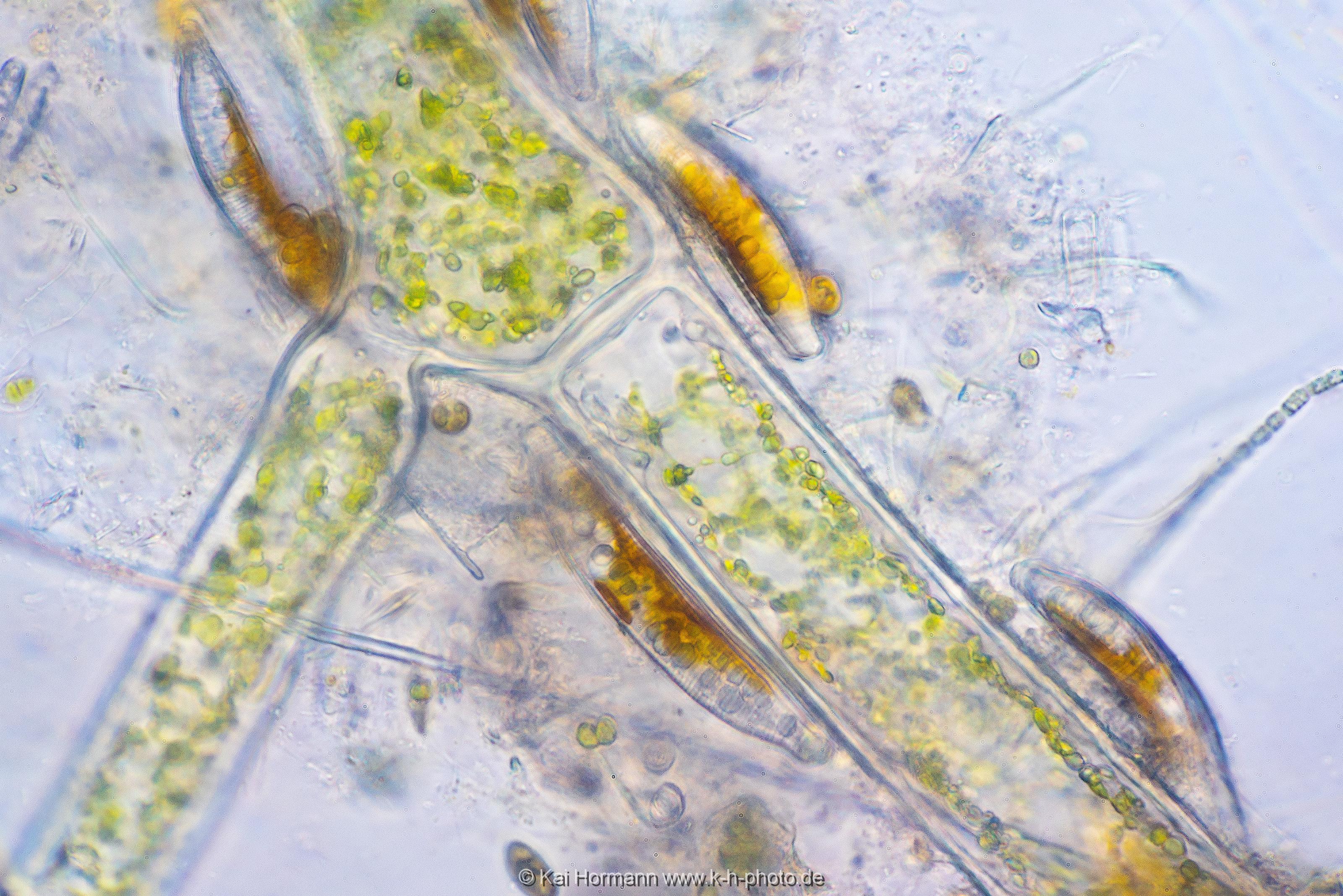 Kieselalgen auf Faden-Grünalge. Mikrofotografie: Mikroskopische Aufnahmen von Einzellern, Algen und Kleinstlebewesen.