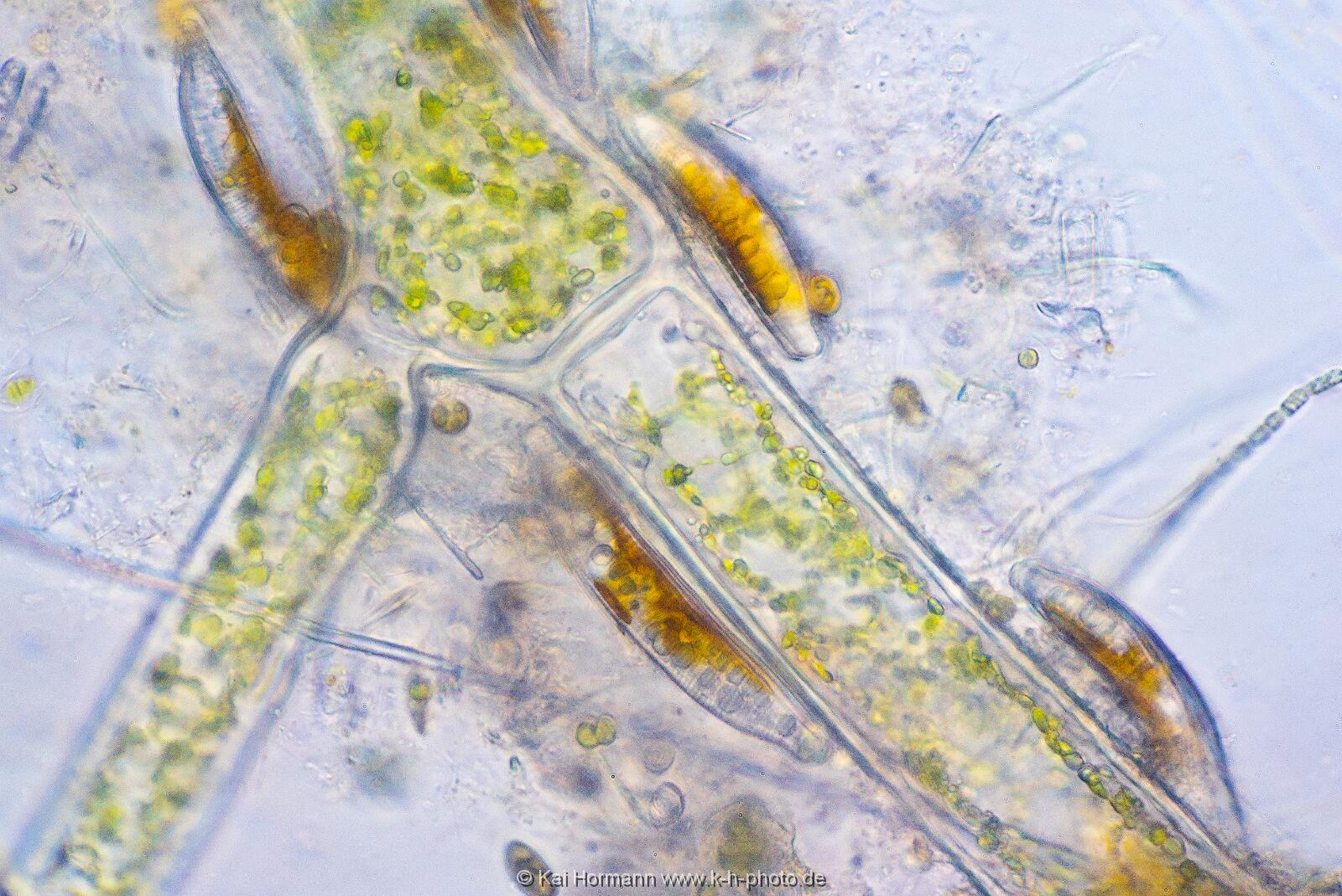 Kieselalgen auf Faden-Grünalge. Mikrofotografie: Mikroskopische Aufnahmen von Einzellern, Algen und Kleinstlebewesen.