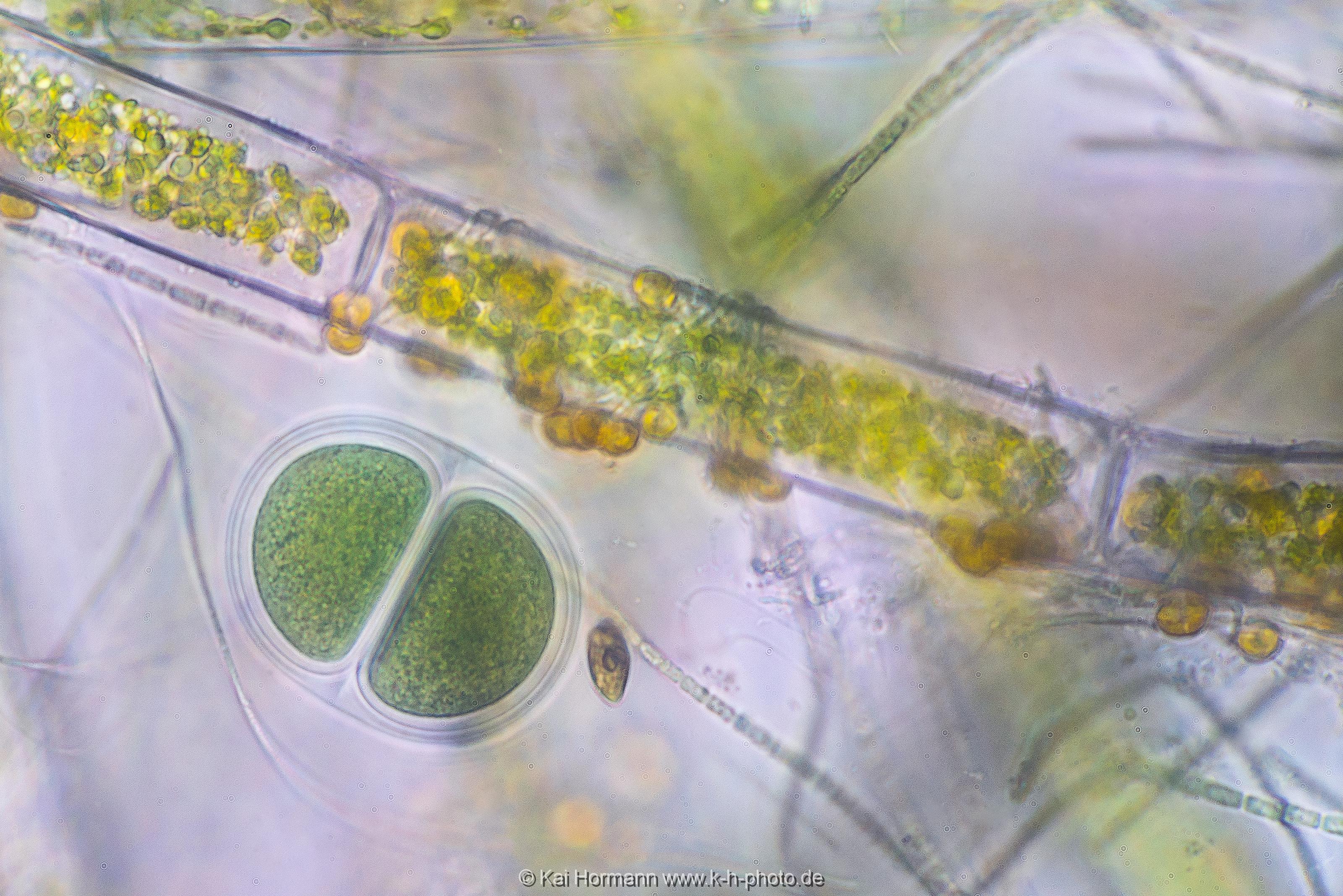 Kugelblaualge Mikrofotografie: Mikroskopische Aufnahmen von Einzellern, Algen und Kleinstlebewesen.