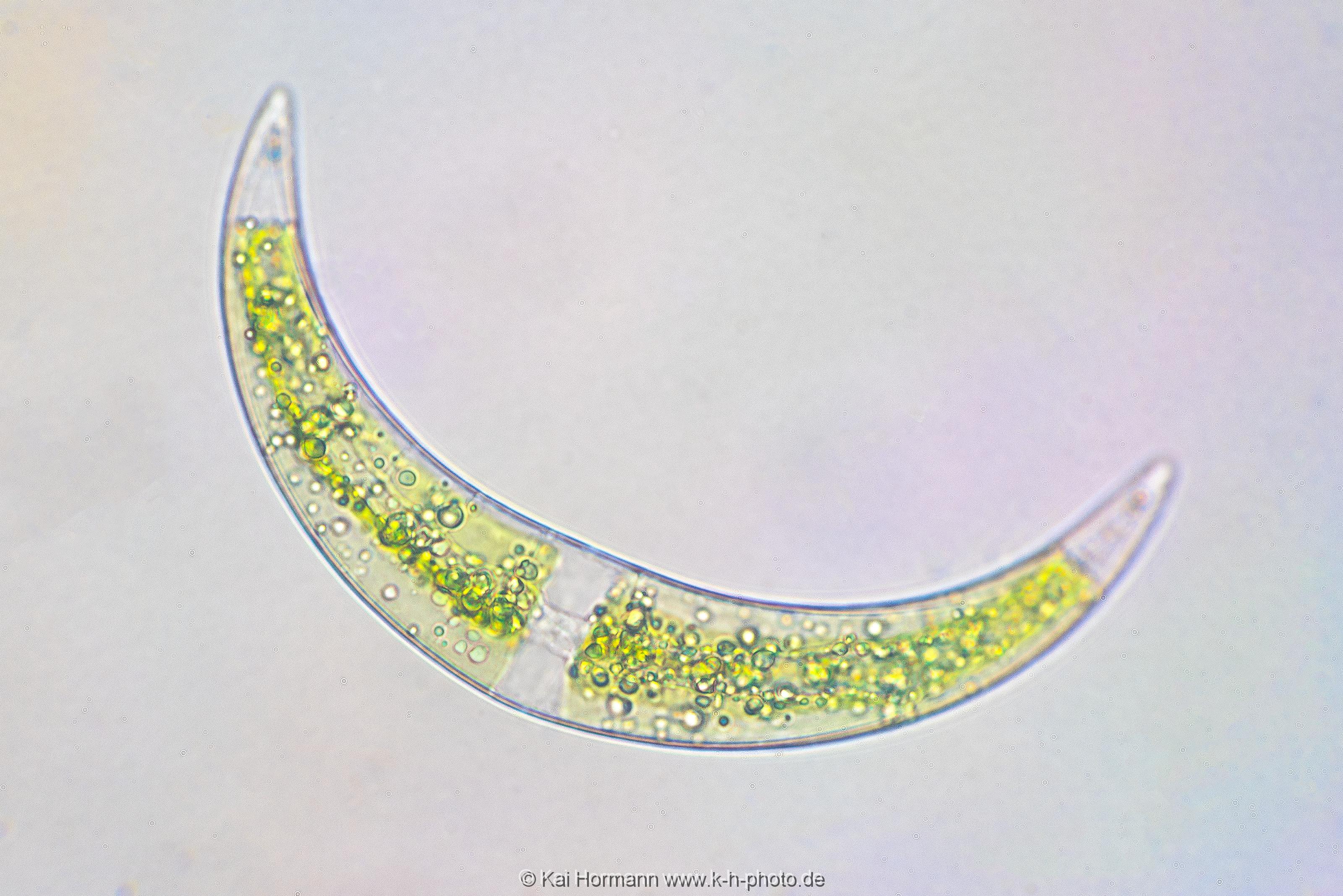 Mondalge Mikrofotografie: Mikroskopische Aufnahmen von Einzellern, Algen und Kleinstlebewesen.