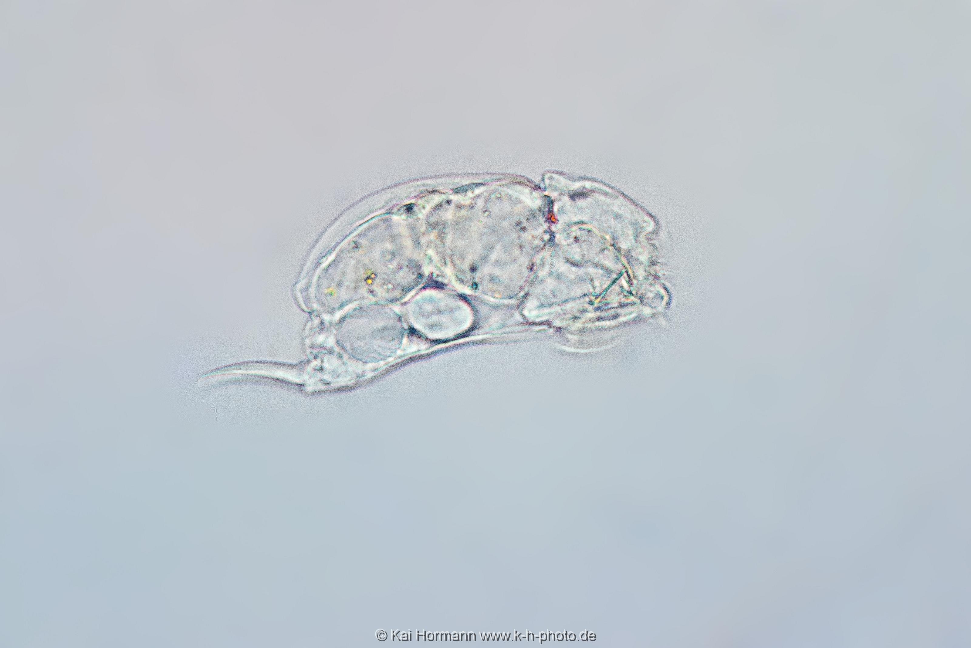 Mützen-Rädertier (Seitenansicht). Mikrofotografie: Mikroskopische Aufnahmen von Einzellern, Algen und Kleinstlebewesen.