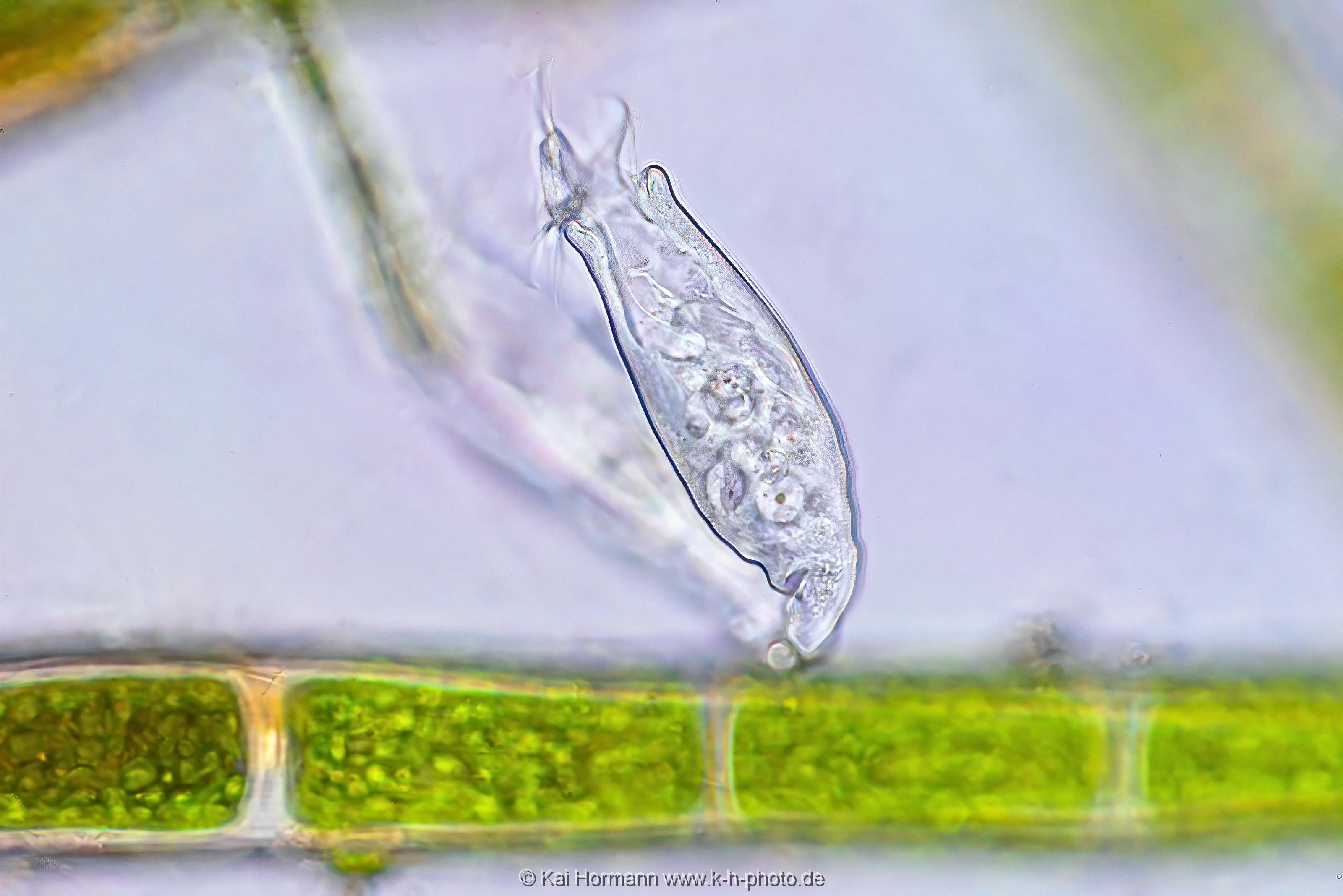 Scyphidia Rugosa. Mikrofotografie: Mikroskopische Aufnahmen von Einzellern, Algen und Kleinstlebewesen.