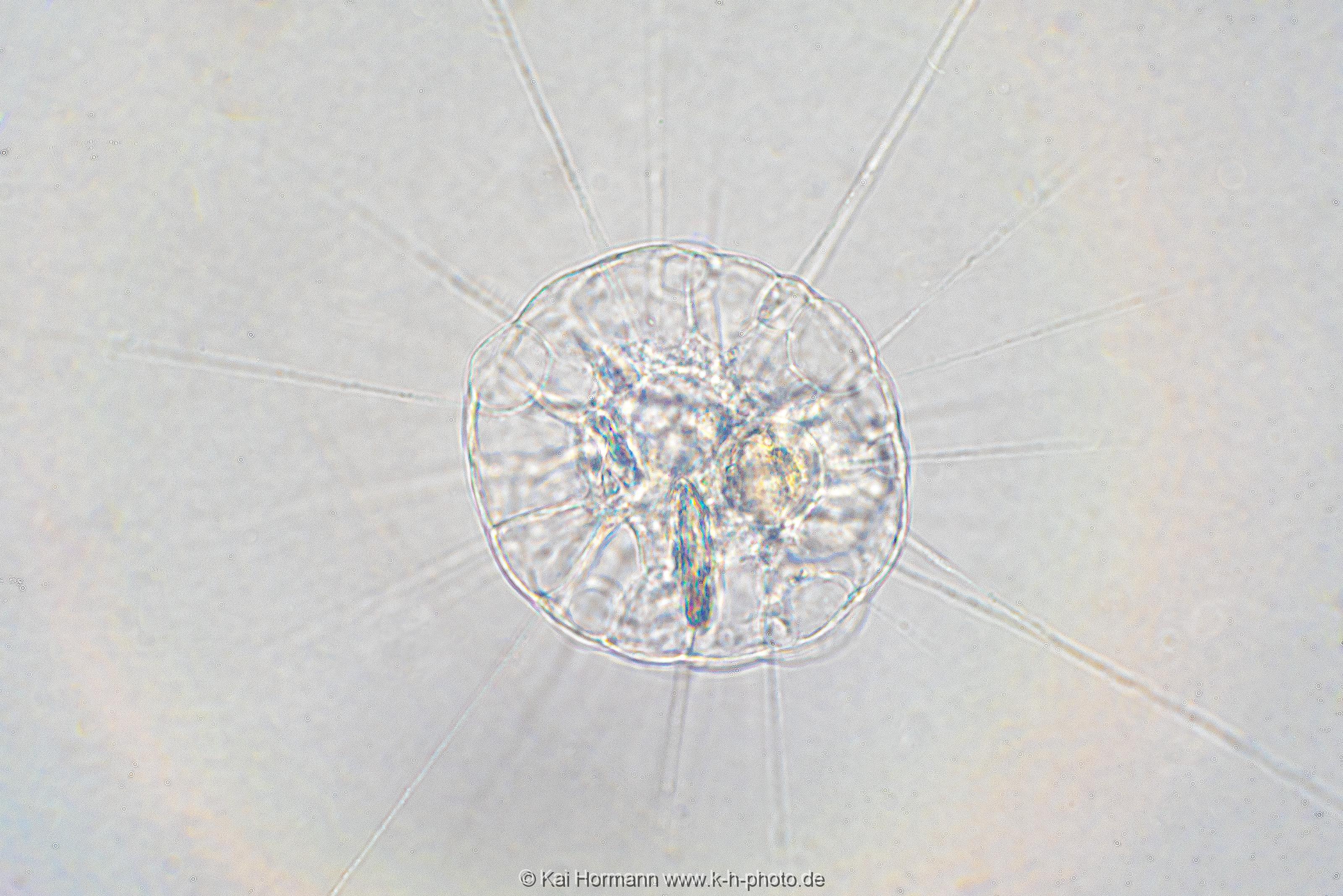 Sonnentierchen Mikrofotografie: Mikroskopische Aufnahmen von Einzellern, Algen und Kleinstlebewesen.