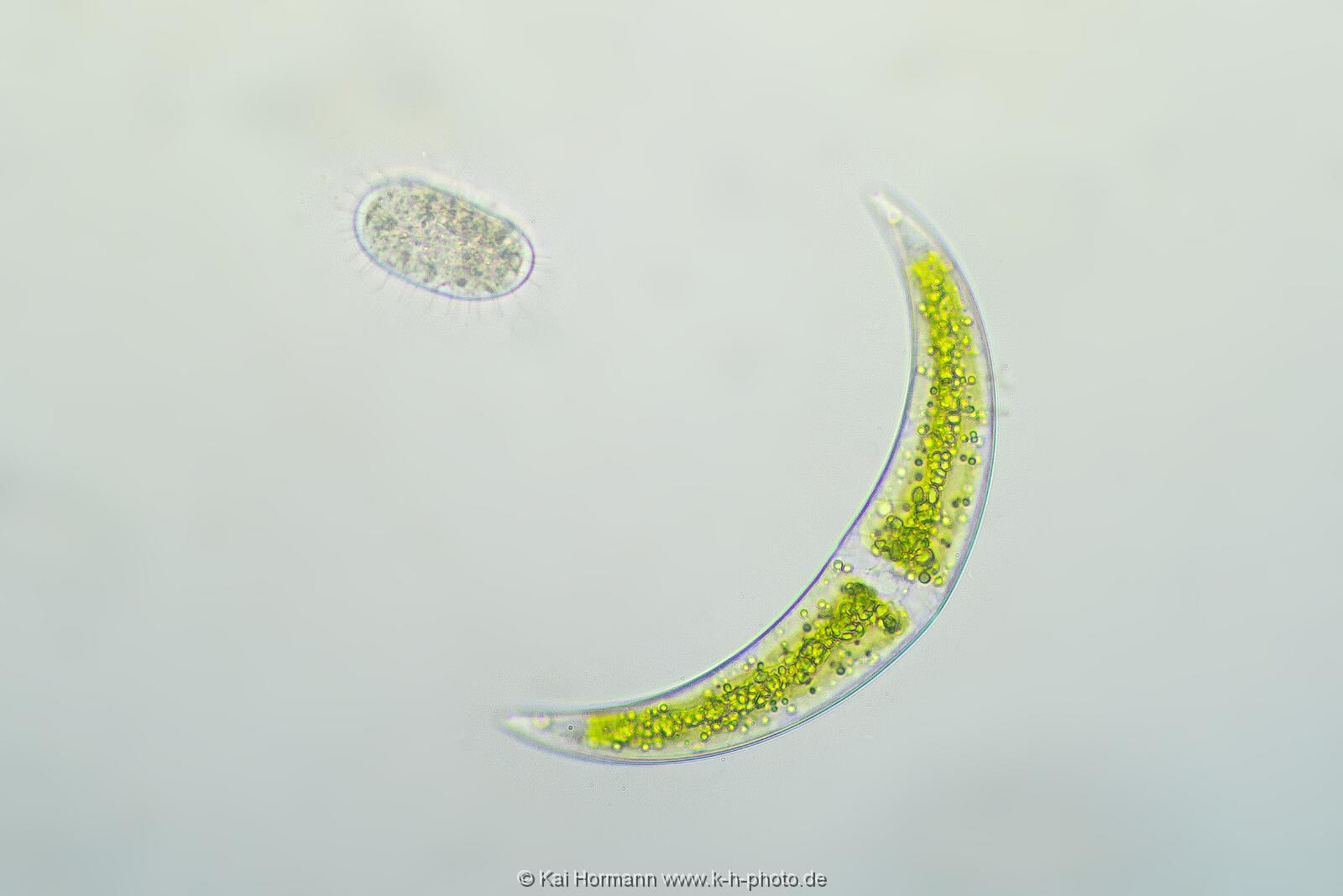 Wimpertierchen und Mondalge. Mikrofotografie: Mikroskopische Aufnahmen von Einzellern, Algen und Kleinstlebewesen.