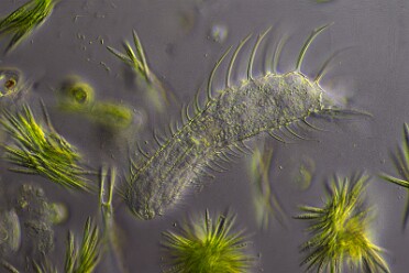 Chaetonotus hystrix