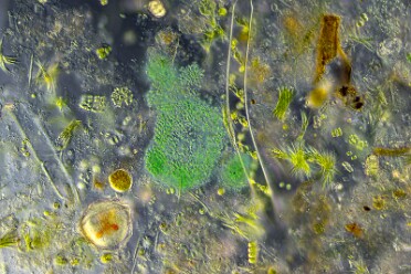 Diverse Mikro Flora und Fauna 2