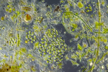 Diverse Mikro Flora und Fauna 3