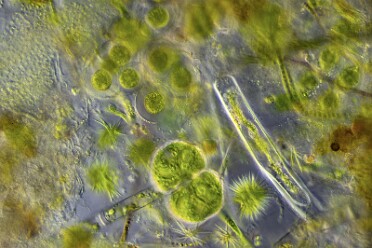 Diverse Mikro Flora und Fauna 4