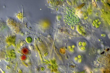 Diverse Mikro Flora und Fauna 5