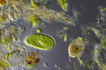 Diverse Mikro Flora und Fauna 7