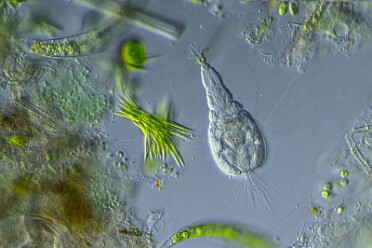 Rädertierchen Collotheca 2