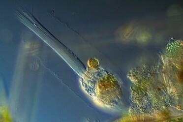 Rädertierchen Collotheca