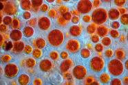 Blutregenalge Haematococcus pluvialis. 1