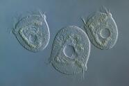 Glockentierchen Vorticellidae.