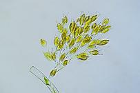 Goldalge Dinobryon sertularia. Mikrofotografie: Mikroskopische Aufnahmen von Einzellern, Algen und Kleinstlebewesen.