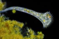 Trompetentierchen. (Dunkelfeld-Aufnahme) Mikrofotografie: Mikroskopische Aufnahmen von Einzellern, Algen und Kleinstlebewesen.
