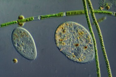 vermutlich Holophrya teres